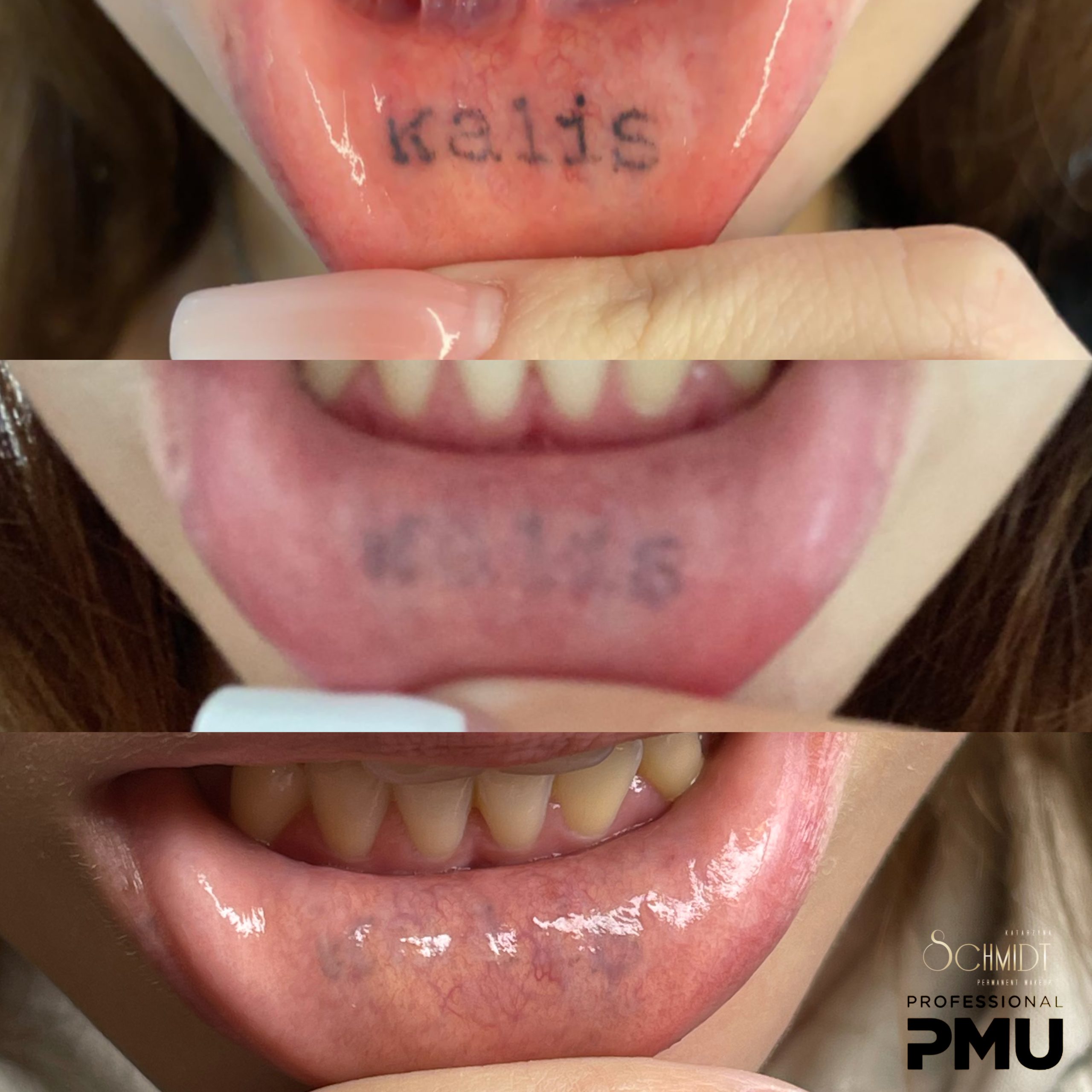 Permanent Make-up Removal